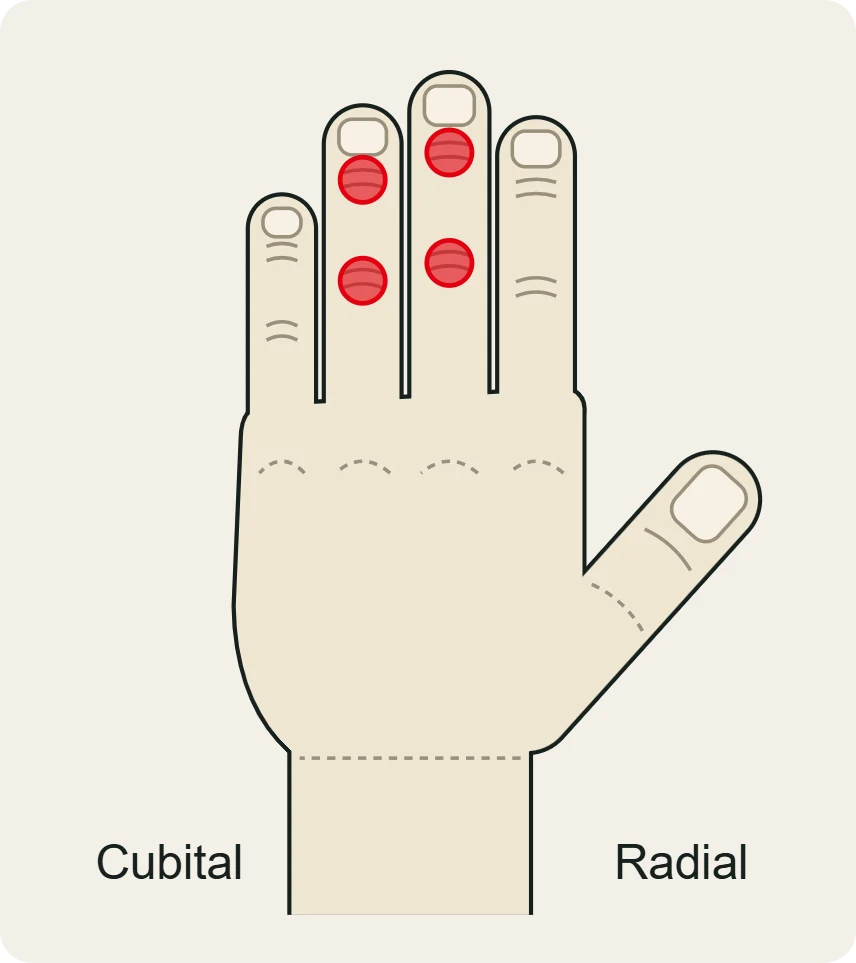 Las articulaciones donde los estudios en escaladores veteranos ven más cambios: interfalángicas distales y proximales del medio y el anular.