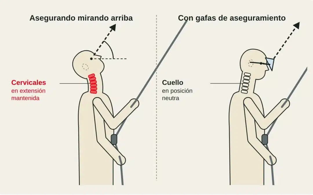 Esquema de un asegurador de perfil: cuello en extensión mirando arriba frente a cuello neutro con gafas de aseguramiento.