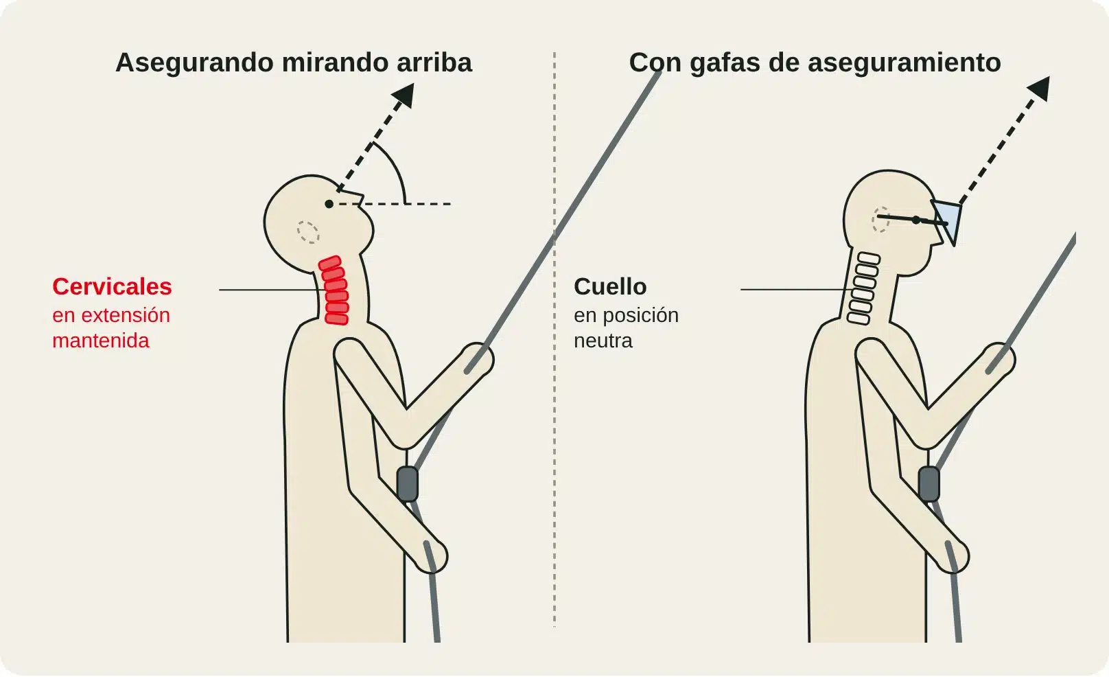 Esquema de un asegurador de perfil: cuello en extensión mirando arriba frente a cuello neutro con gafas de aseguramiento.