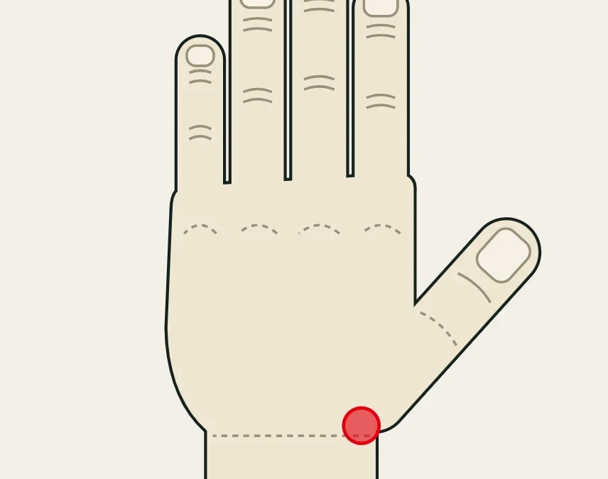 De Quervain: dolor sobre la estiloides radial, en la muñeca por el lado del pulgar.