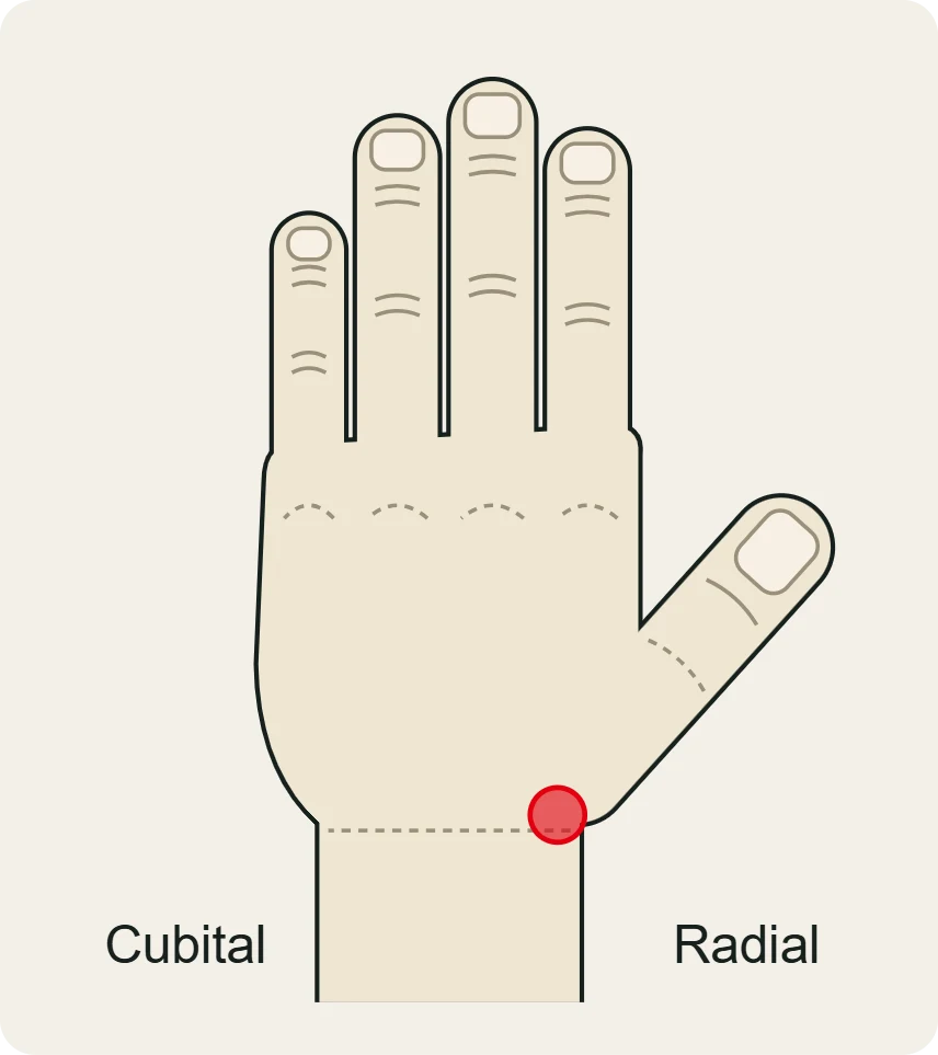De Quervain: dolor sobre la estiloides radial, en la muñeca por el lado del pulgar.