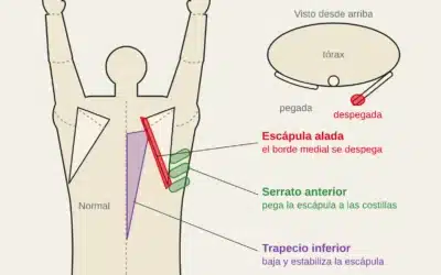 Discinesia escapular en escaladores: cómo se valora y qué ejercicios funcionan