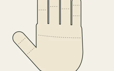 Jersey finger: avulsión del flexor profundo (FDP) en escaladores