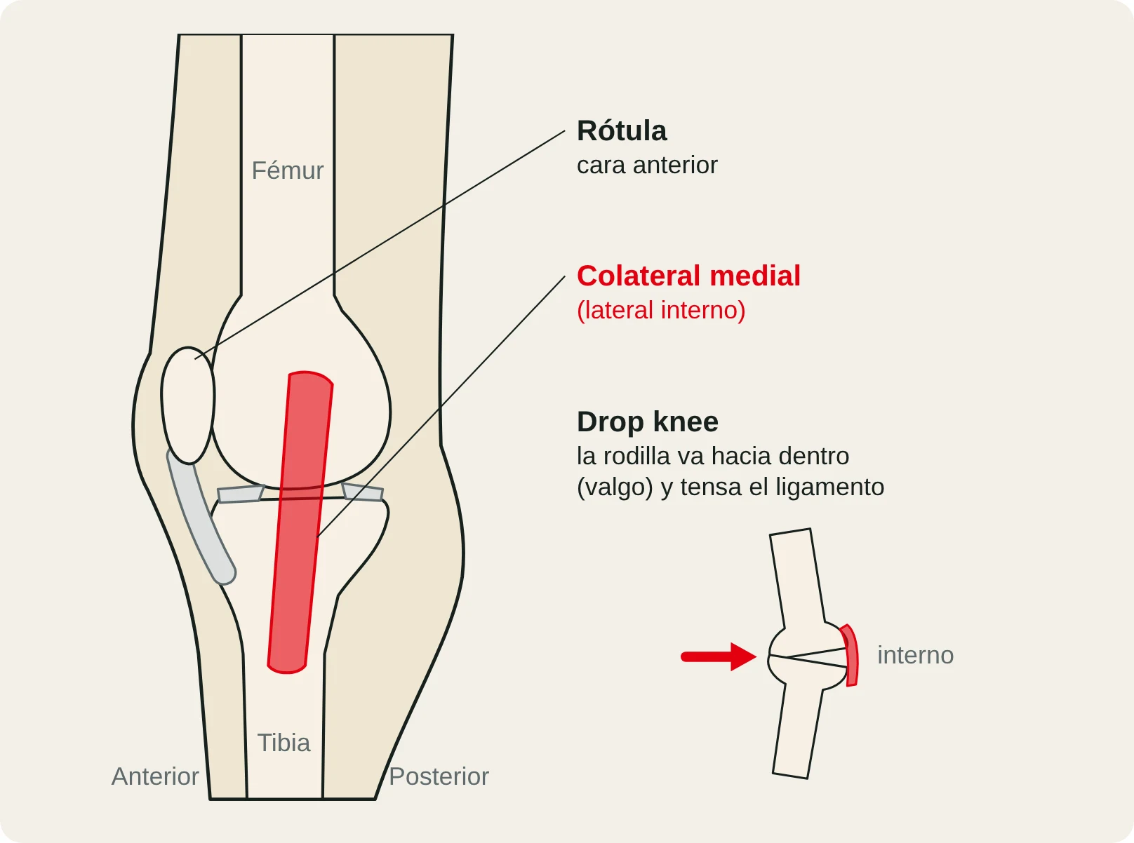 Vista medial de la rodilla con el ligamento colateral medial (lateral interno): en el drop knee la rodilla se va hacia dentro (valgo) y lo tensa.