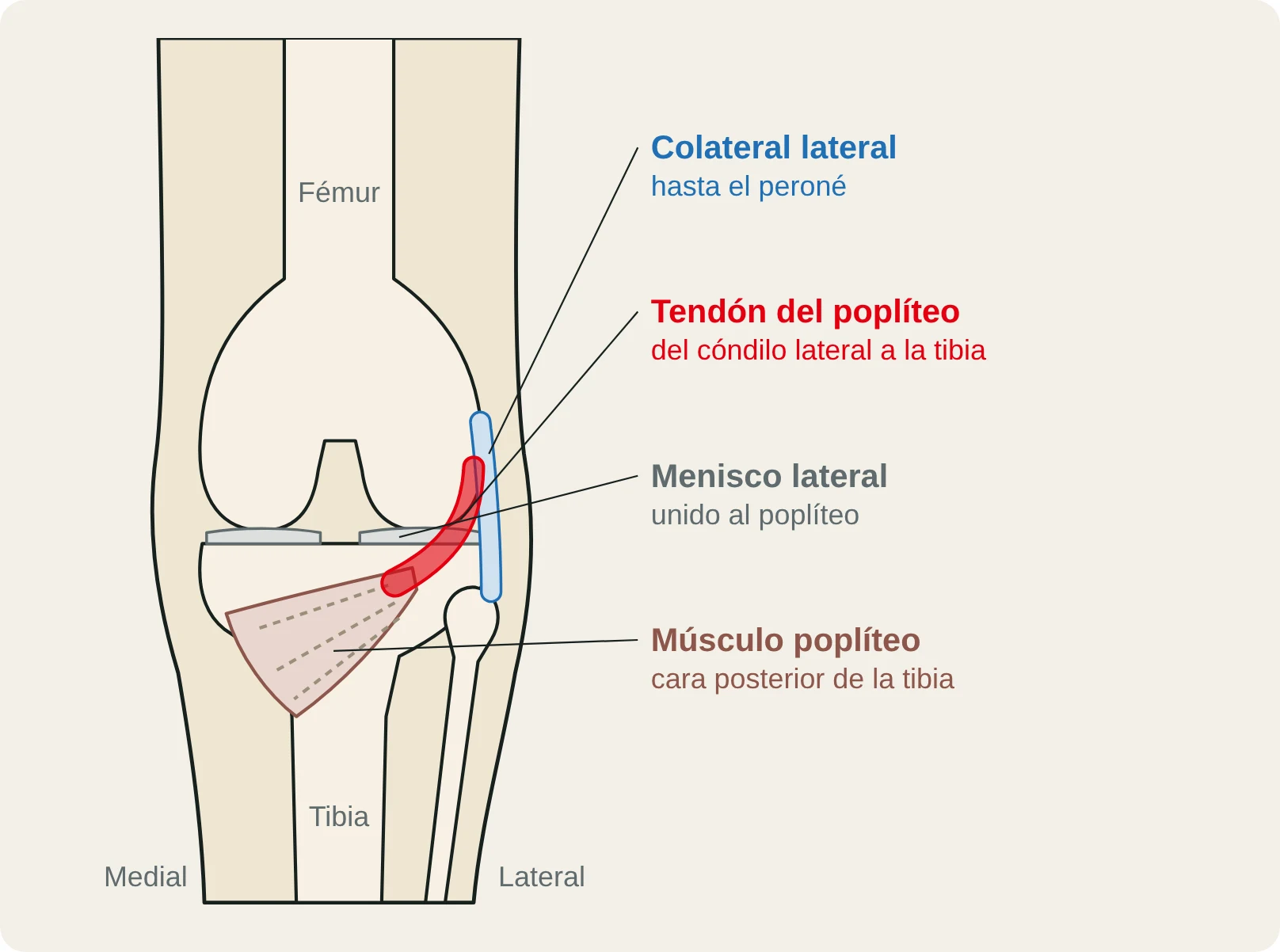 Vista posterior de la rodilla con el tendón del poplíteo, junto al colateral lateral y el menisco lateral.