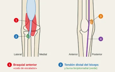 Lesiones específicas del codo del escalador: braquial, bíceps, tríceps y nervio cubital