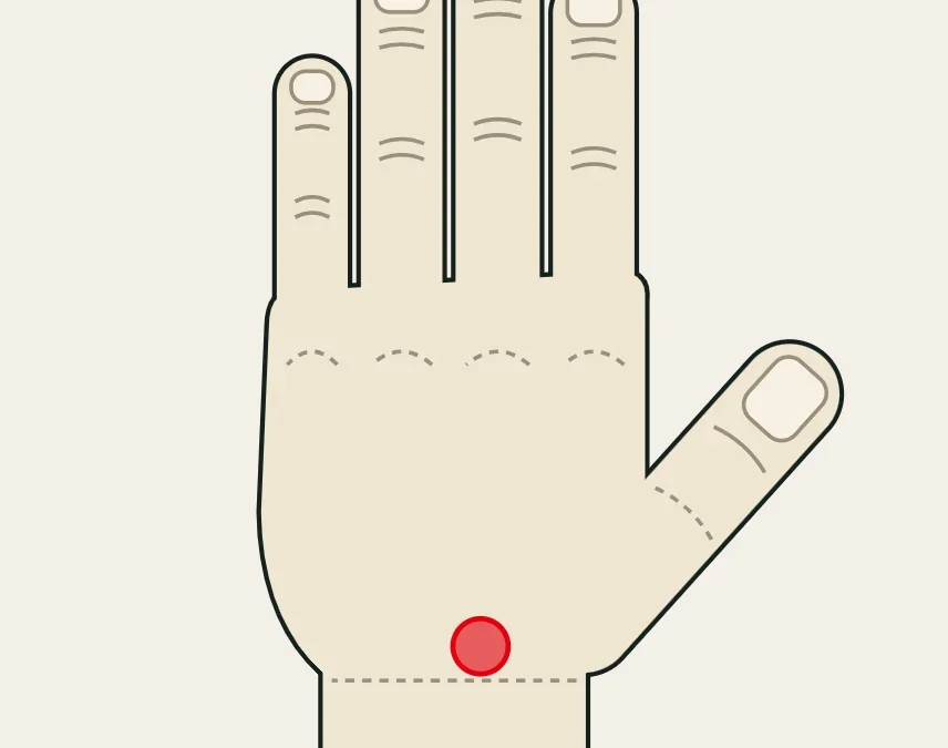 Ligamento escafolunar: dolor en el dorso de la muñeca, en el centro del carpo hacia el lado del pulgar.