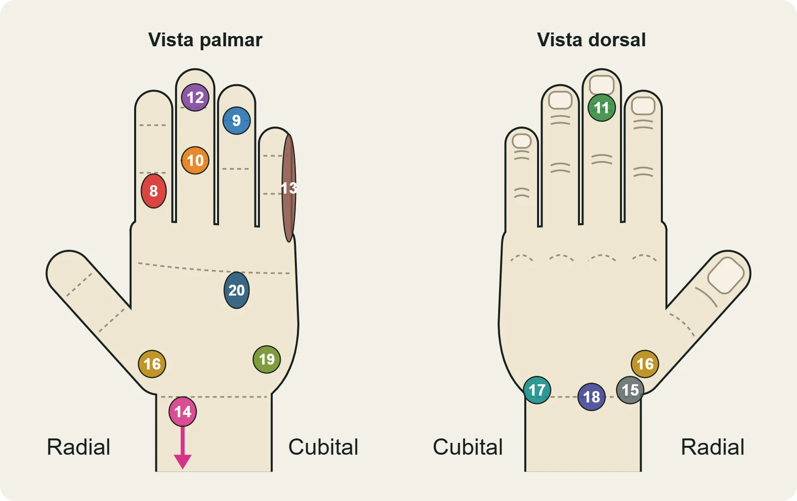 Mapa de otras lesiones de dedos, pulgar y muñeca (8–20), en vista palmar y dorsal.