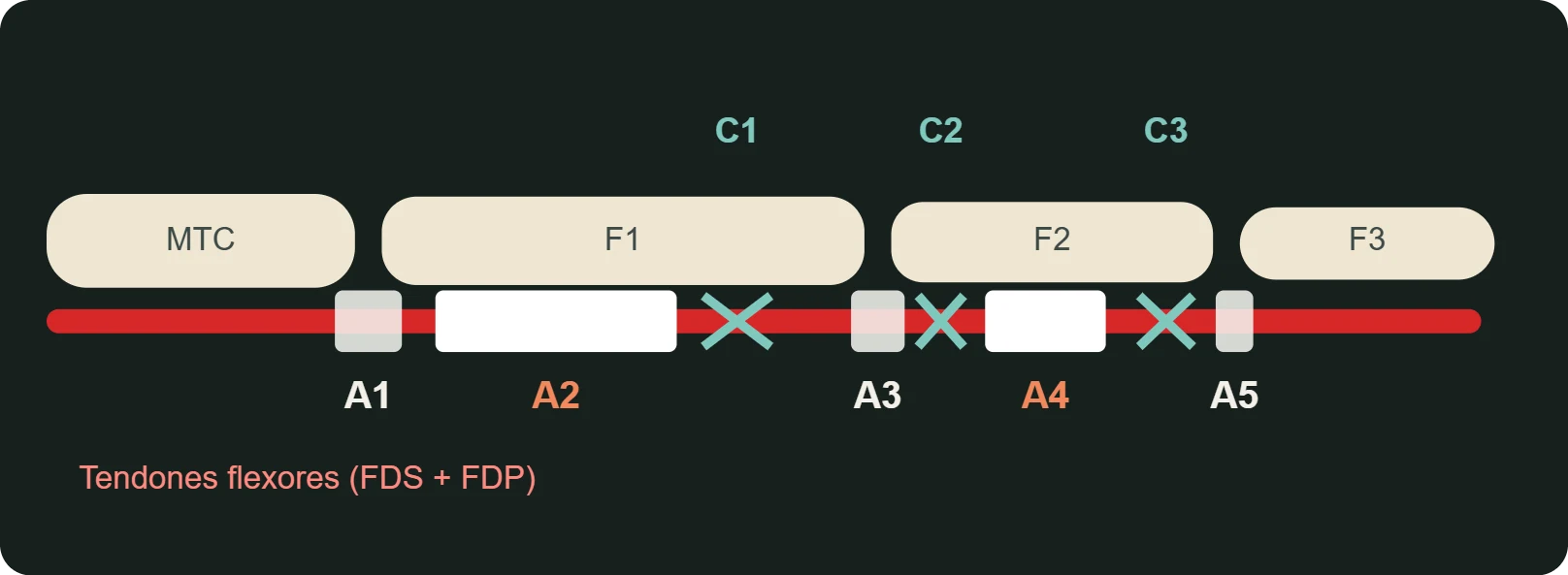 Sistema de poleas de un dedo: anulares A1–A5 y cruciformes C1–C3 sobre los tendones flexores. A2 y A4 son las más importantes.