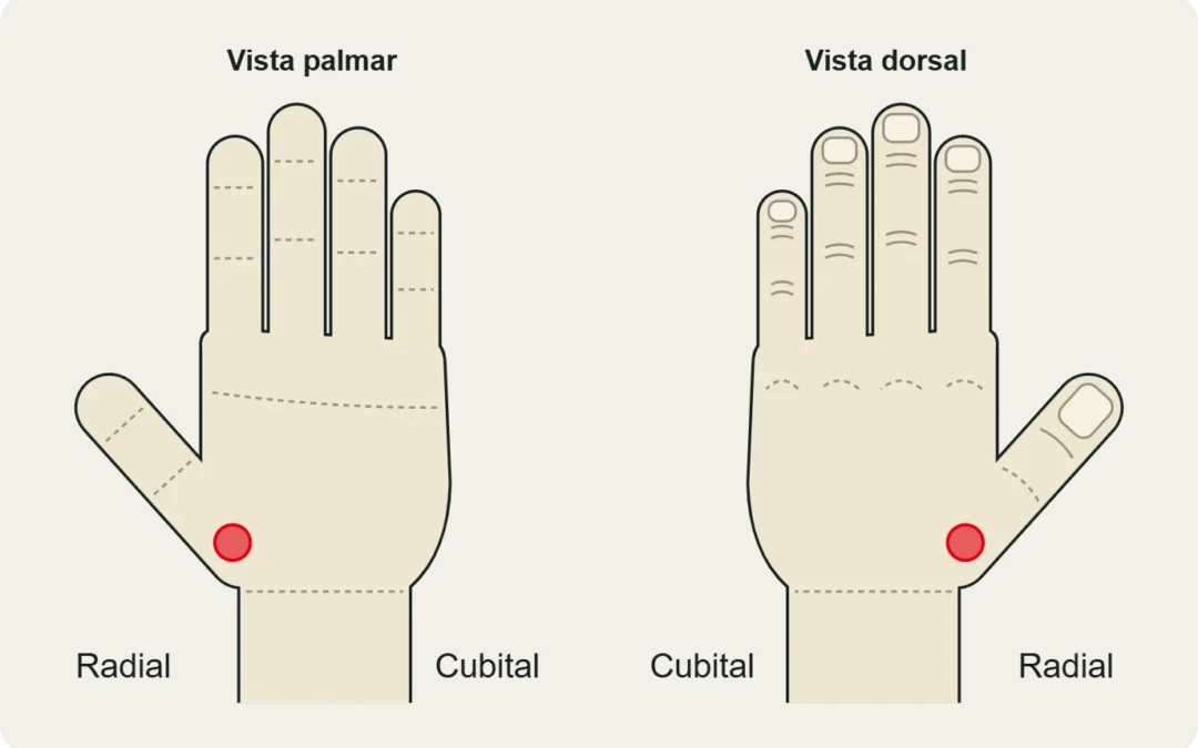 Rizartrosis: dolor en la base del pulgar (articulación trapeciometacarpiana), en vista palmar y dorsal.