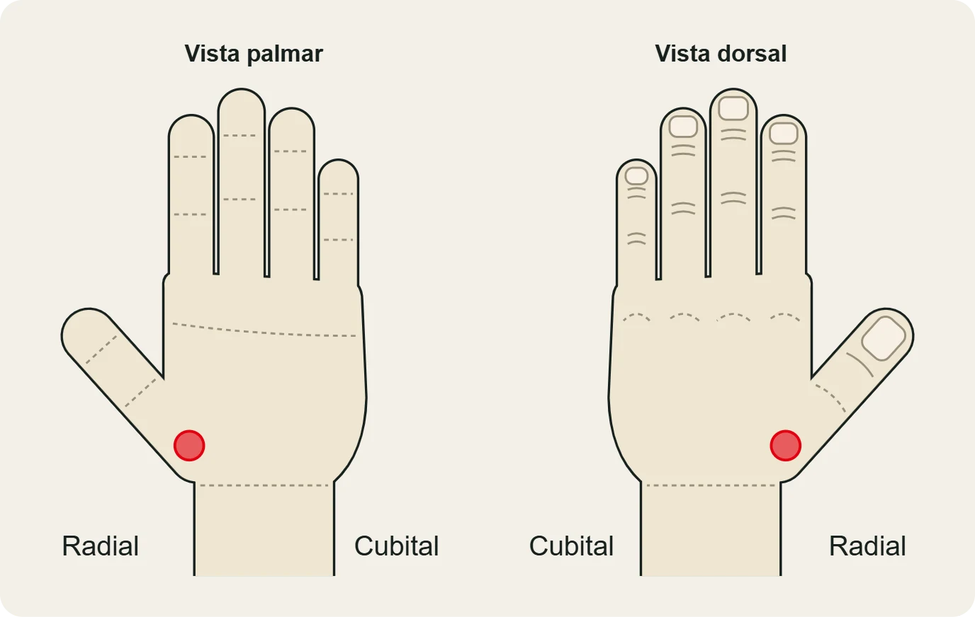 Rizartrosis: dolor en la base del pulgar (articulación trapeciometacarpiana), en vista palmar y dorsal.