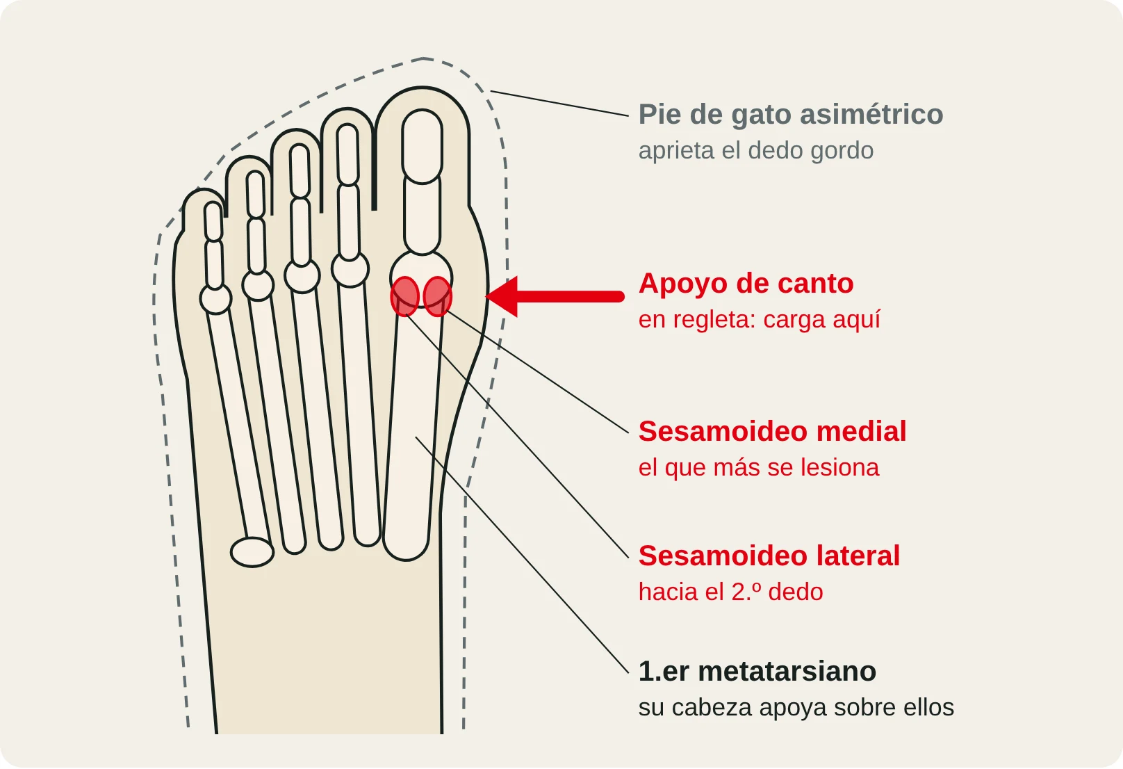 Vista plantar del antepié con los sesamoideos bajo la cabeza del 1.er metatarsiano, que cargan al apoyar de canto en una regleta.