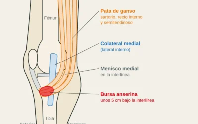 Tendinopatía de la pata de ganso en escaladores: dolor en la cara interna de la rodilla