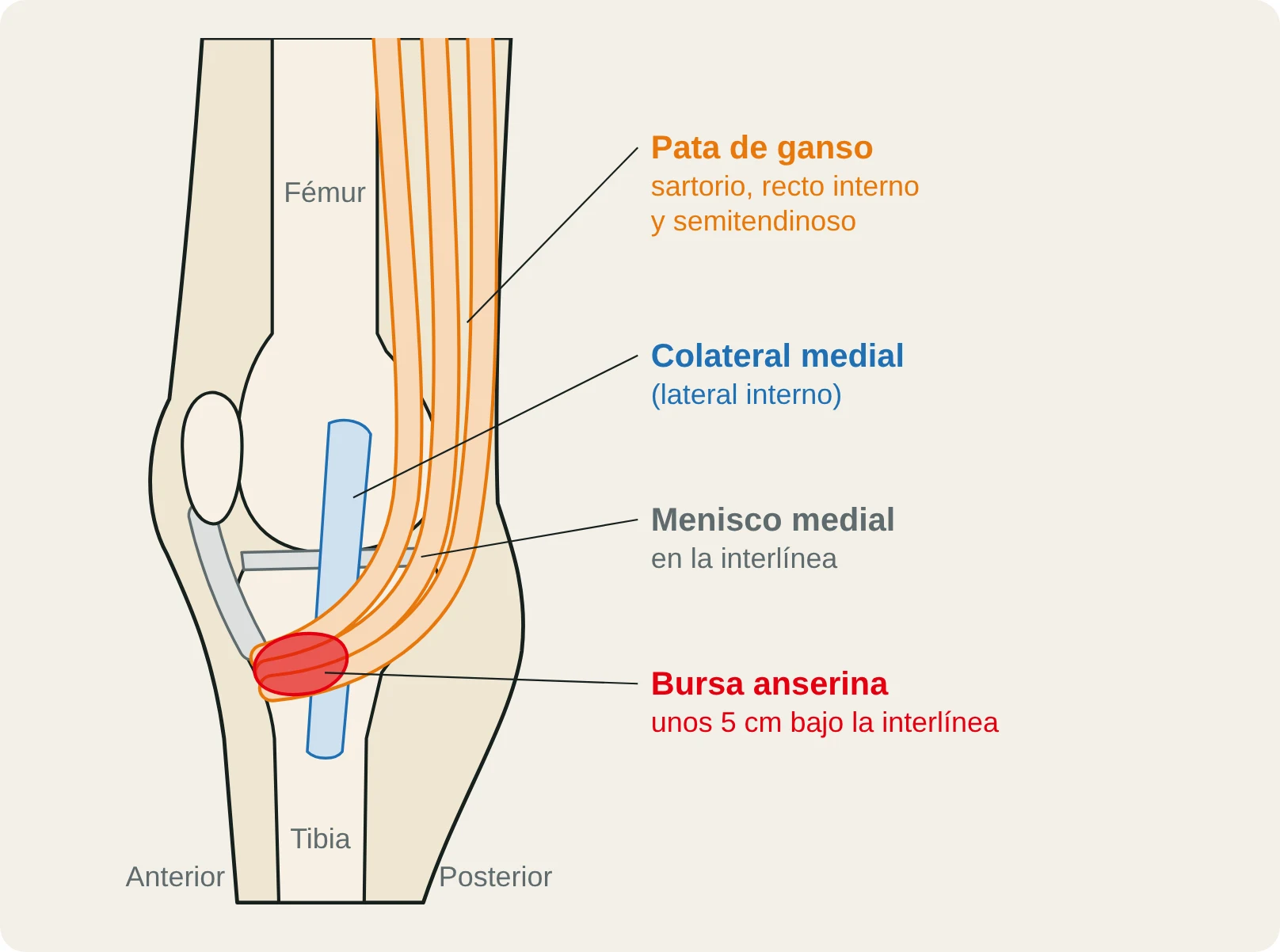 Vista medial de la rodilla con la pata de ganso (sartorio, recto interno y semitendinoso) y la bursa anserina, unos 5 cm por debajo de la interlínea.